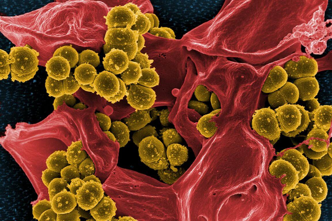 Устойчивые к антибиотикам бактерии жили задолго до появления препаратов
